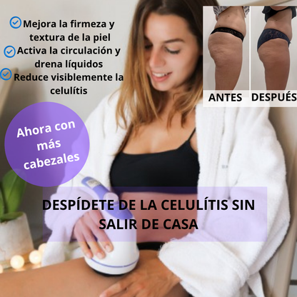 Masajeador 4 en 1 - Despídete de la Celulitis en Menos de 20 Minutos al Día